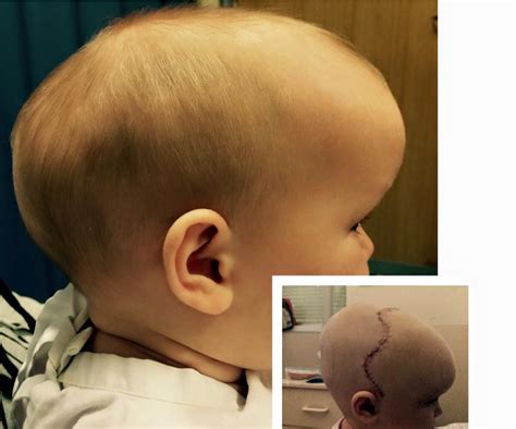 weird shaped head|abnormal head shape baby.